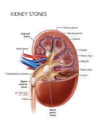 HEALTH_CARE